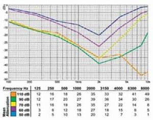 Noise Level chart showing why HearDefenders help protect your ears