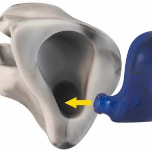 A blue E.A.R. MHS™ 360 Electronic Earplug with an arrow pointing to the gray custom sleeve.